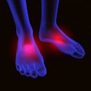 علل داغ شدن و سوزش پاها